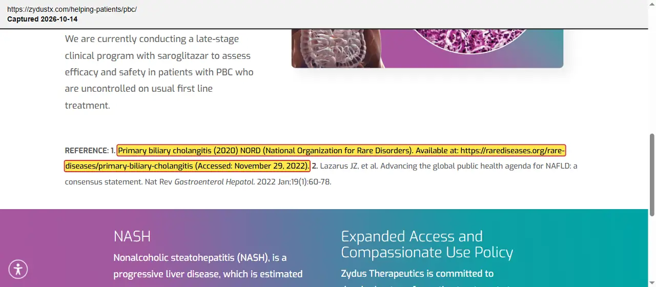 Zydus Therapeutics (2026) website, primary biliary cholangitis page, quoted passage highlighted